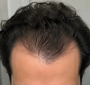 Before
