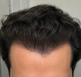 After