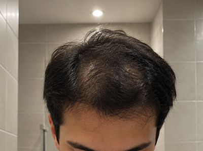 Before