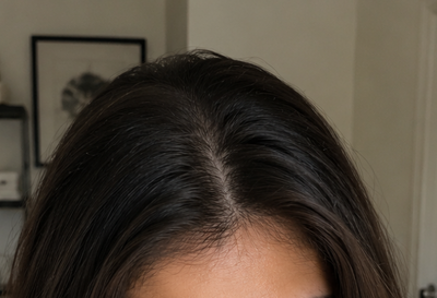 After