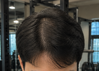 Before